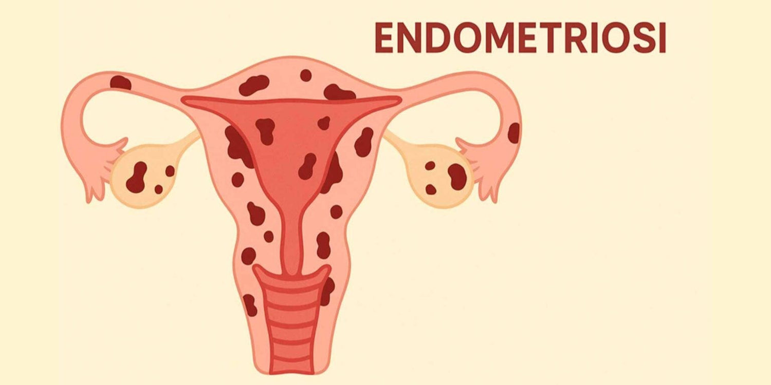 Endometriosi: una patologia complessa, sistemica e spesso invisibile